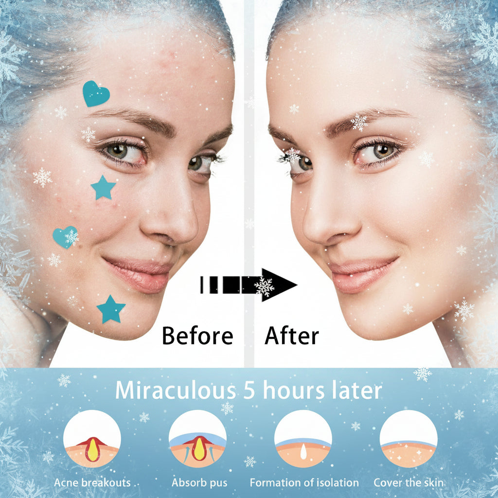 CryoGlow Acne Patches results